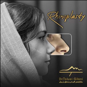 عکس عمل بینی گوشتی - دکتر طلوعی-