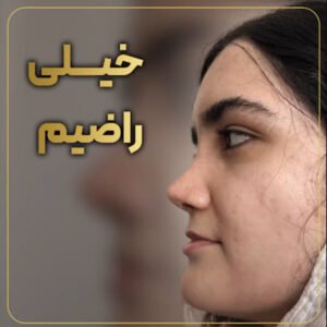عکس جراحی بینی در مازندران - دکتر طلوعی - /drtoluei.com