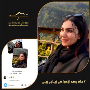 عکس عمل بینی طبیعی - دکتر طلوعی - drtoluei.com