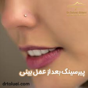 پیرسینگ بعد از عمل بینی - دکتر محمود حسین طلوعی -drtoluei.com