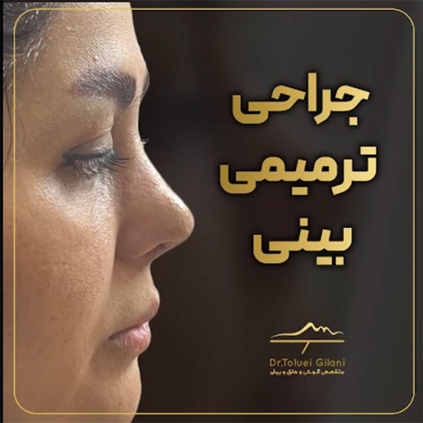 جراحی ترمیمی بینی - دکتر محمود حسین طلوعی-drtoluei.com