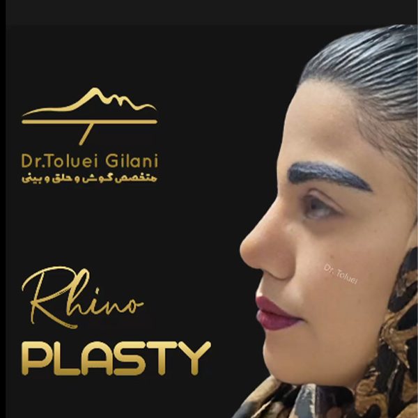 thiclk-skin-nose-rhinoplasty-دکتر محمود حسین طلوعی - drtoluei.com